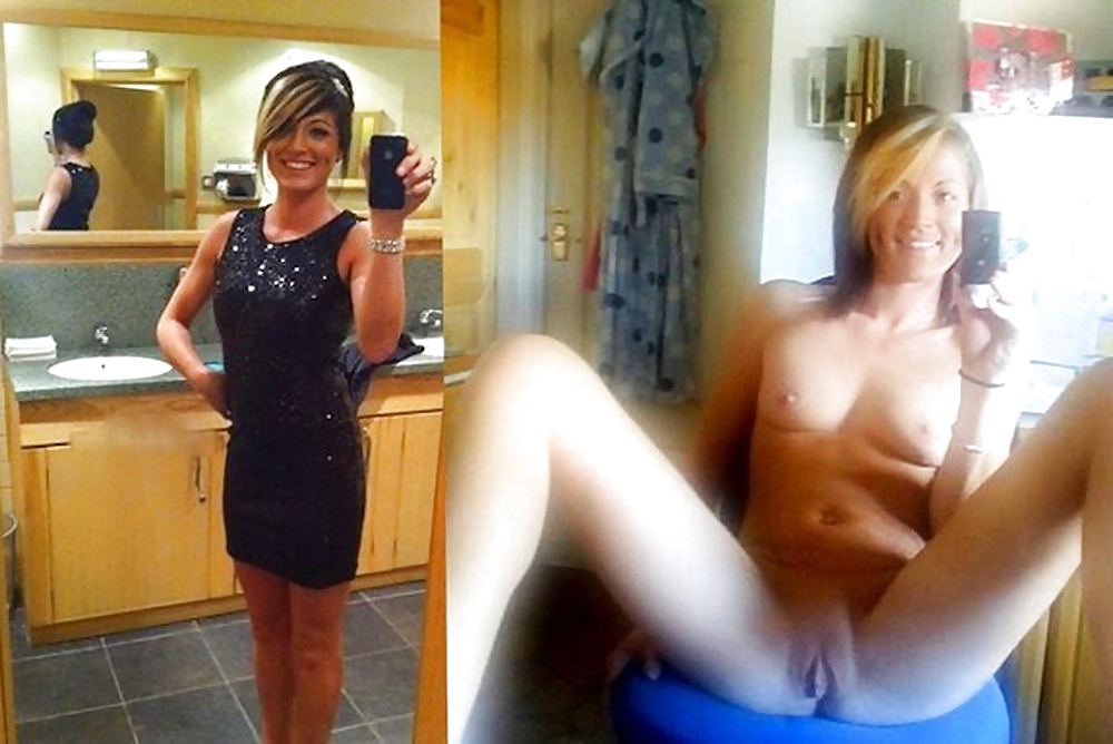 148- before and after 3
 #29094821