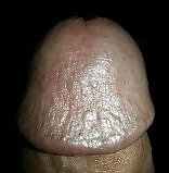 Head #23384410