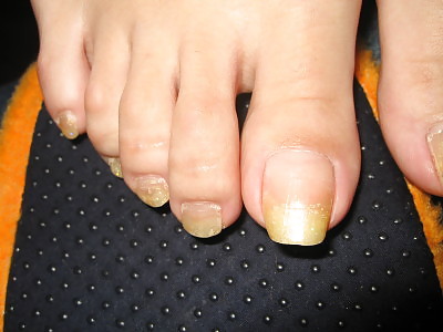 Asiatische Küken Mit Langen Nägeln Und Lange Fußnägel 2 #35648106