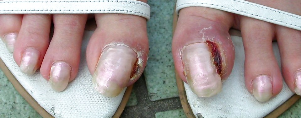 Ragazze asiatiche con unghie lunghe e unghie dei piedi lunghe 2
 #35648118