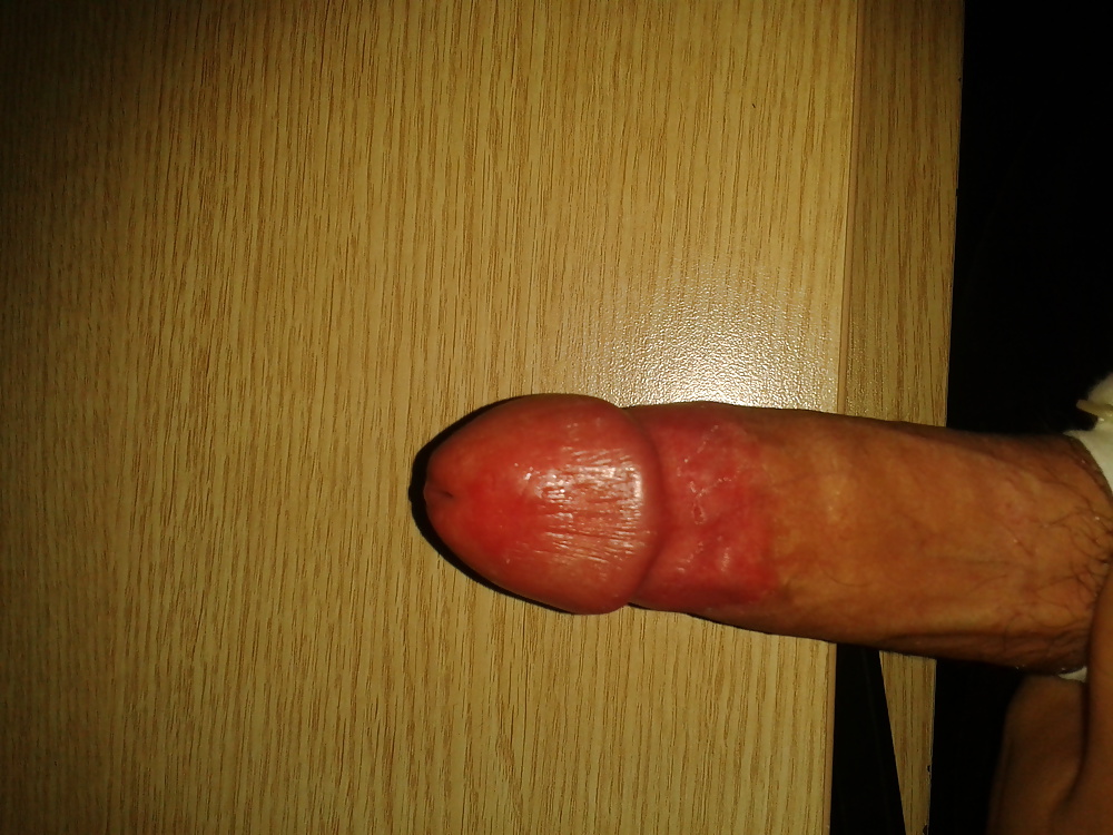 Oops #32142583