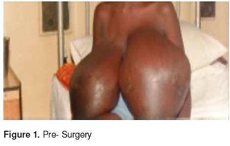 Extrema macromastia tetas negras 7
 #25972747