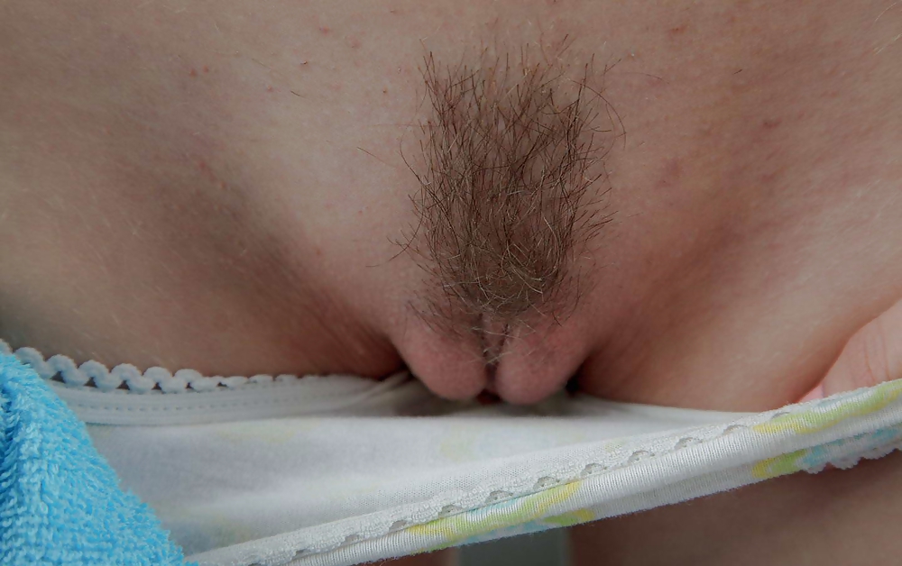 From the Moshe Files: Show Us Your Hairy Beaver #36533259