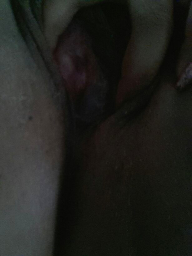 Todo
 #26532472