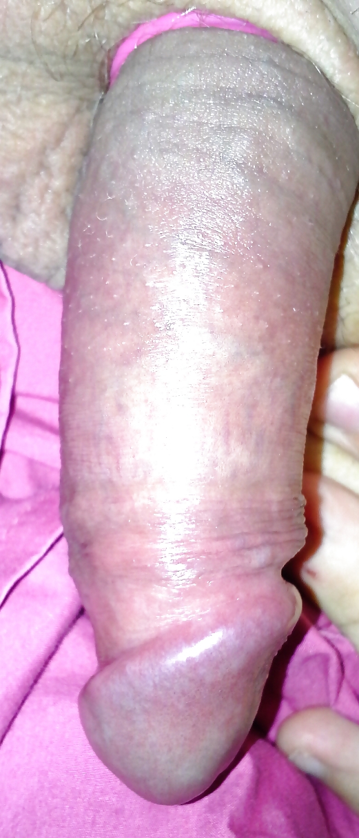 Please comment. #23515762