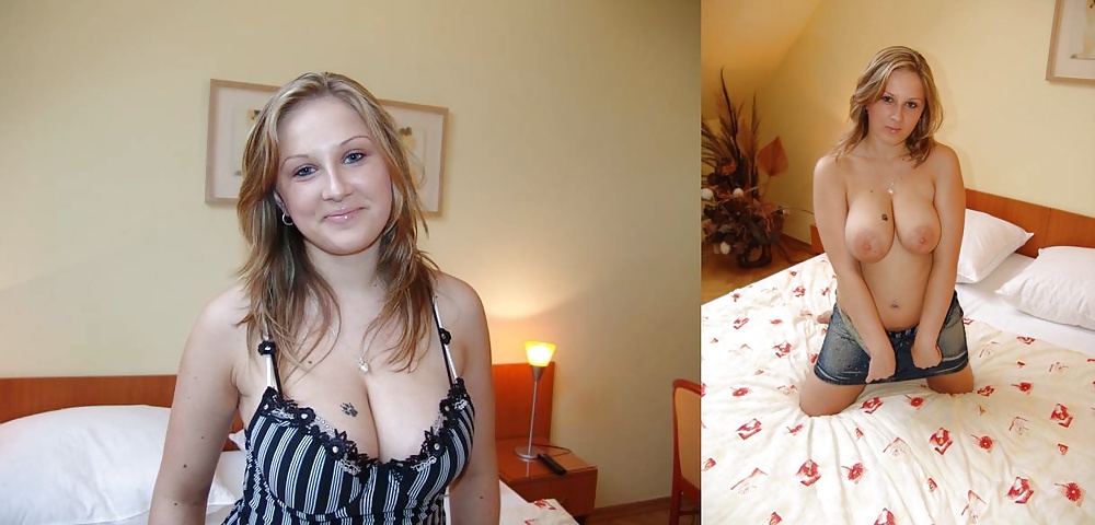 Before and After (Part 2) #31938533