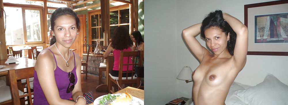 Before and After (Part 2) #31938541