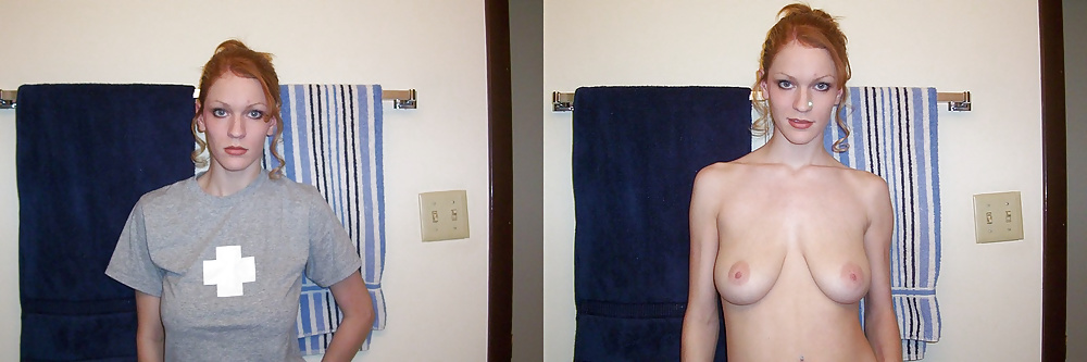Before and After (Part 2) #31938545