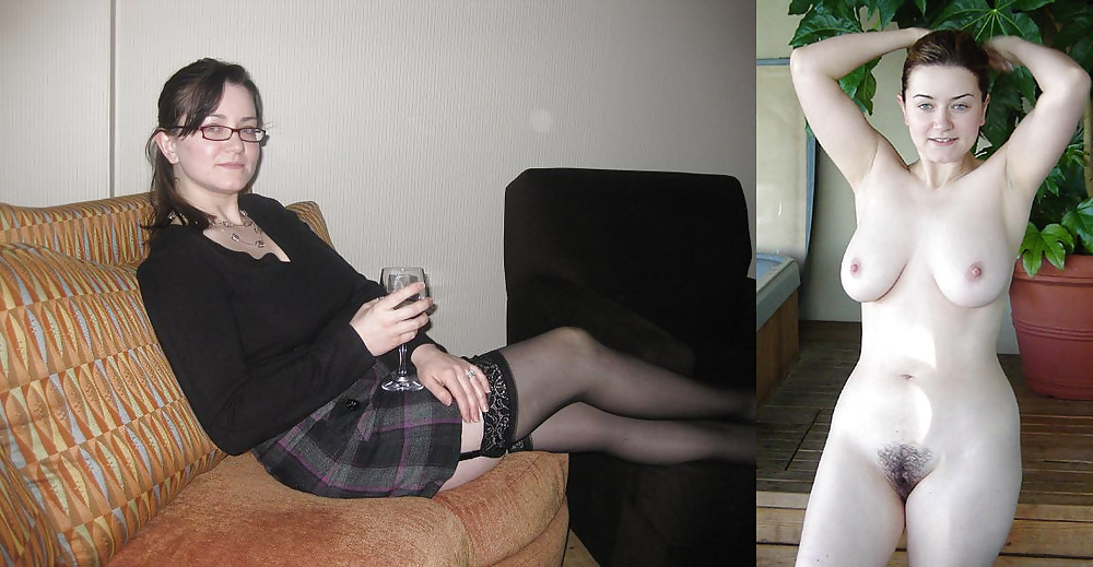 Before and After (Part 2) #31938569