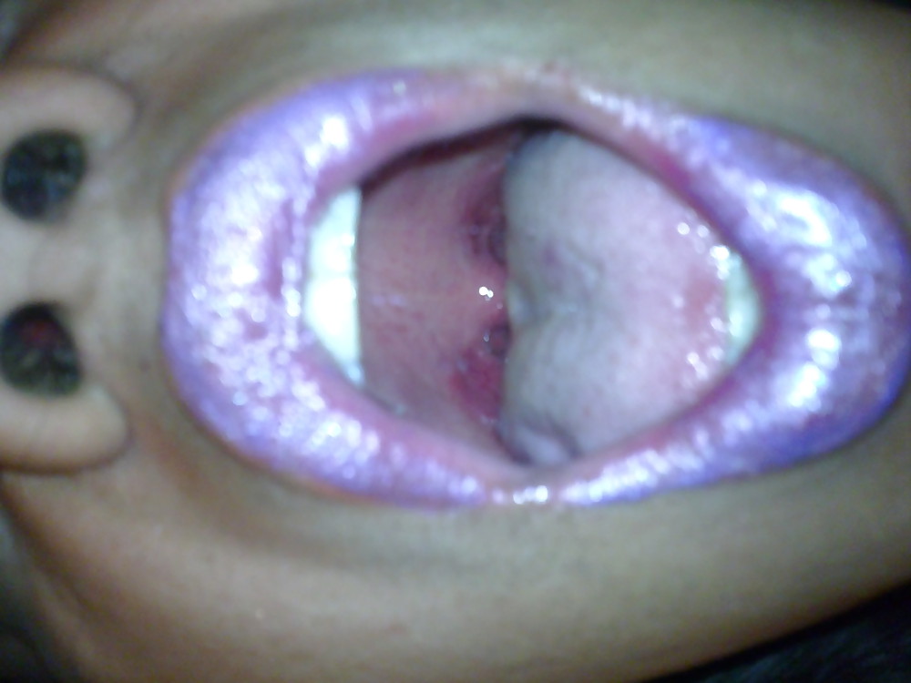 マ・ブッシュ
 #33363379