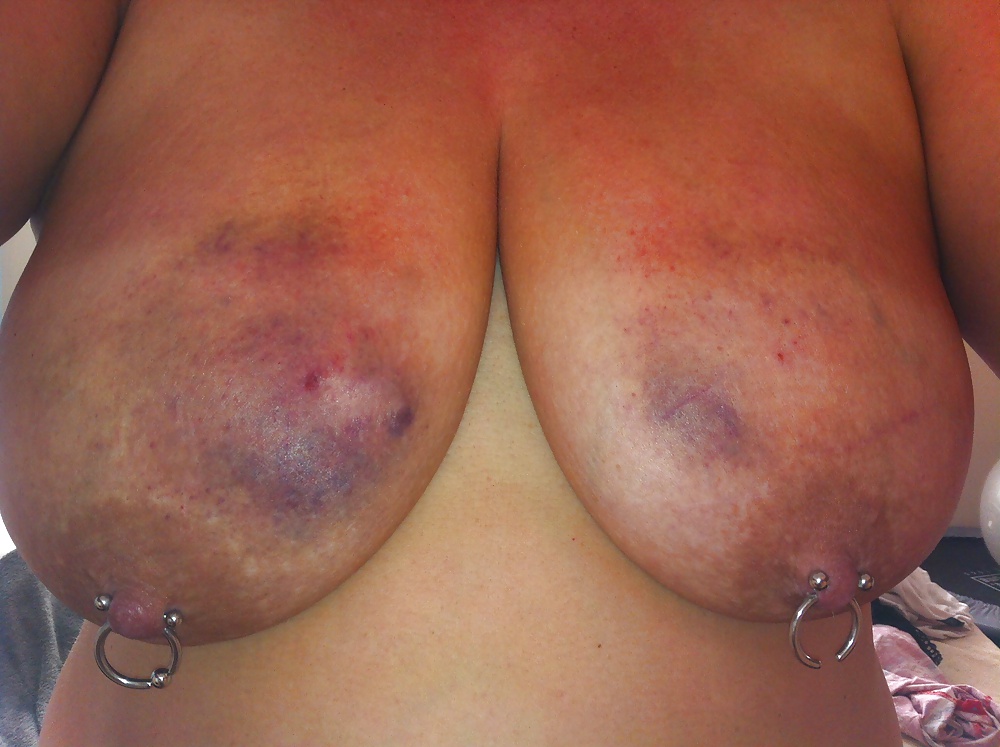 Scottish sluts - loving bruised tits #28389042
