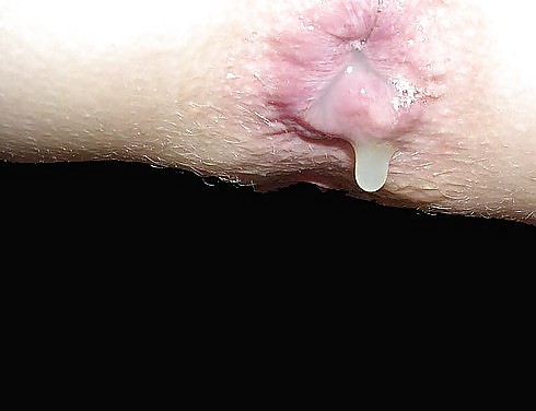 Open ass for fisting! #33279013