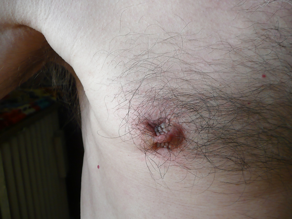 Pinzas duras - pinces dures
 #26198157