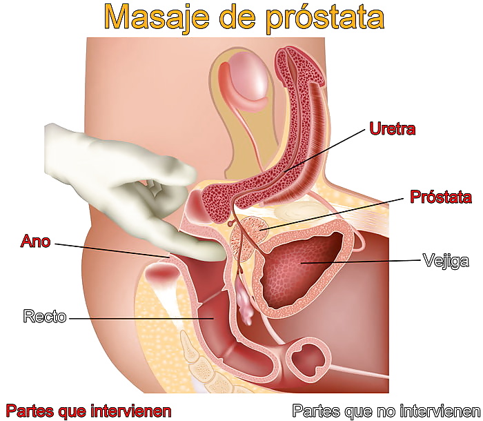 Prostate #34628683