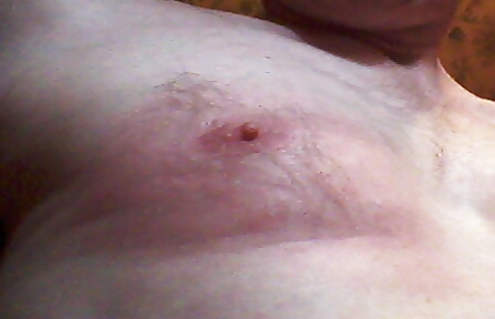 Harte Strafe Strafe Nesseln Nesseln Bdsm #37371421
