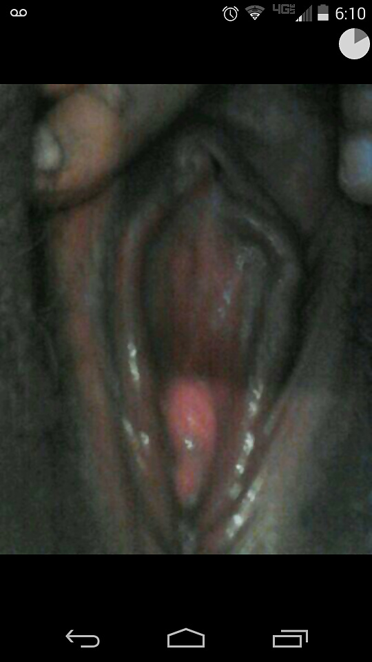 Suma
 #27717212