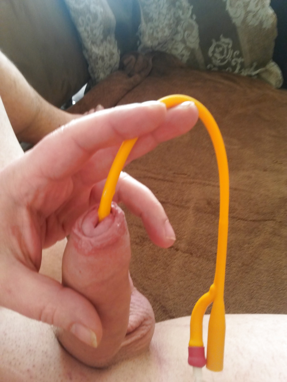 Katheter spiele
 #41017506