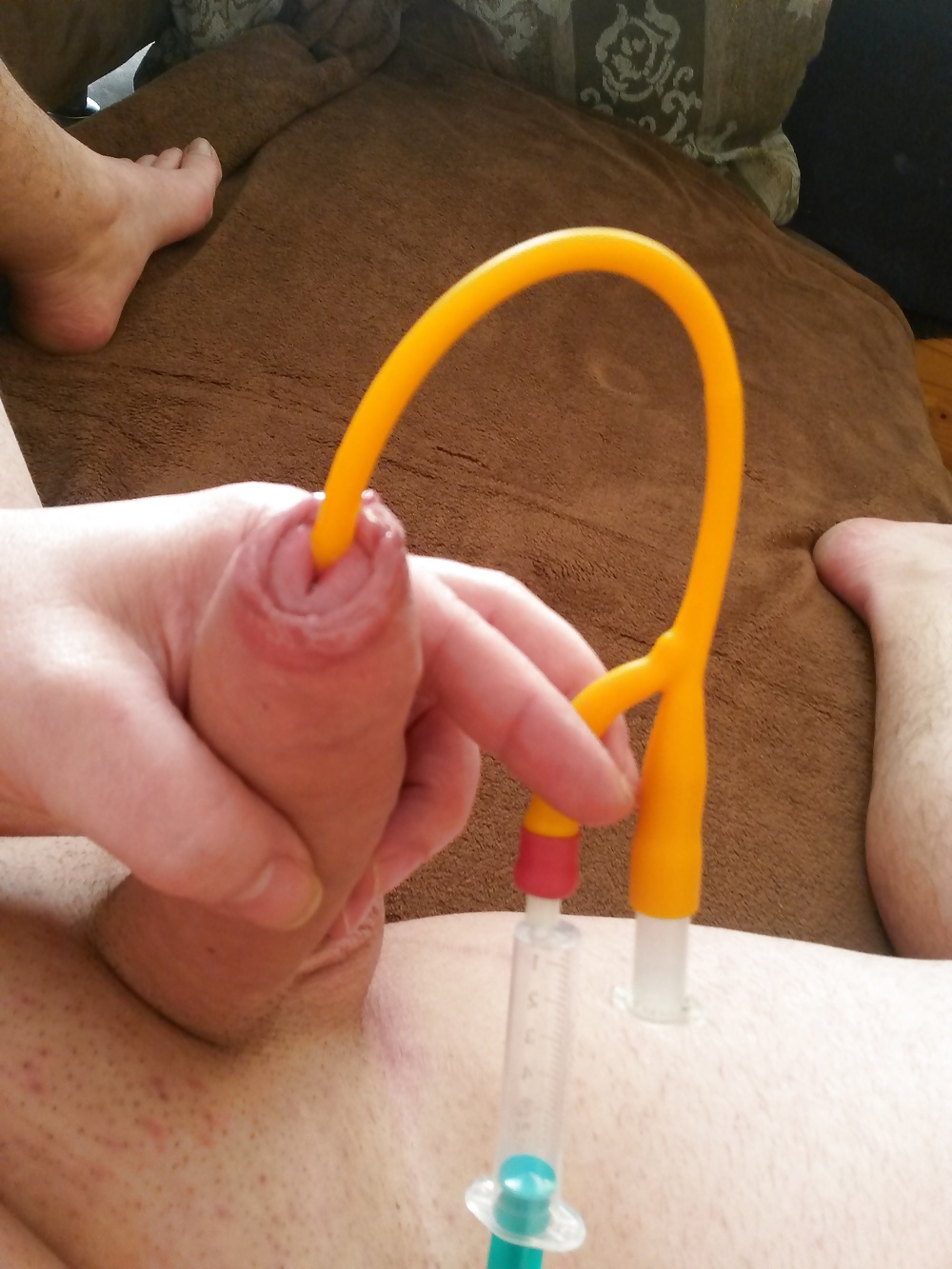 カテーテル治療
 #41017528