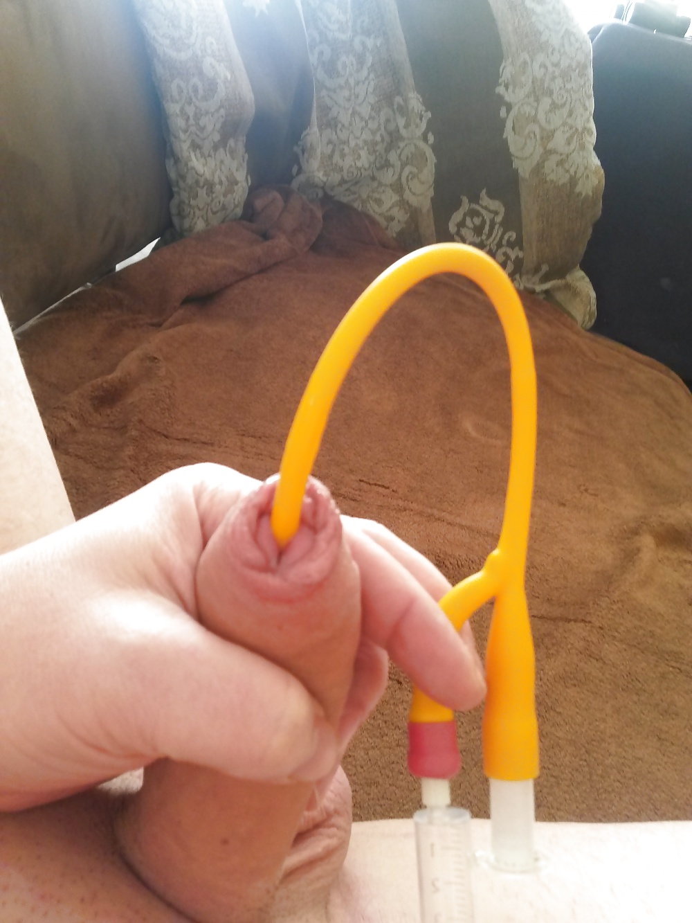 カテーテル治療
 #41017536