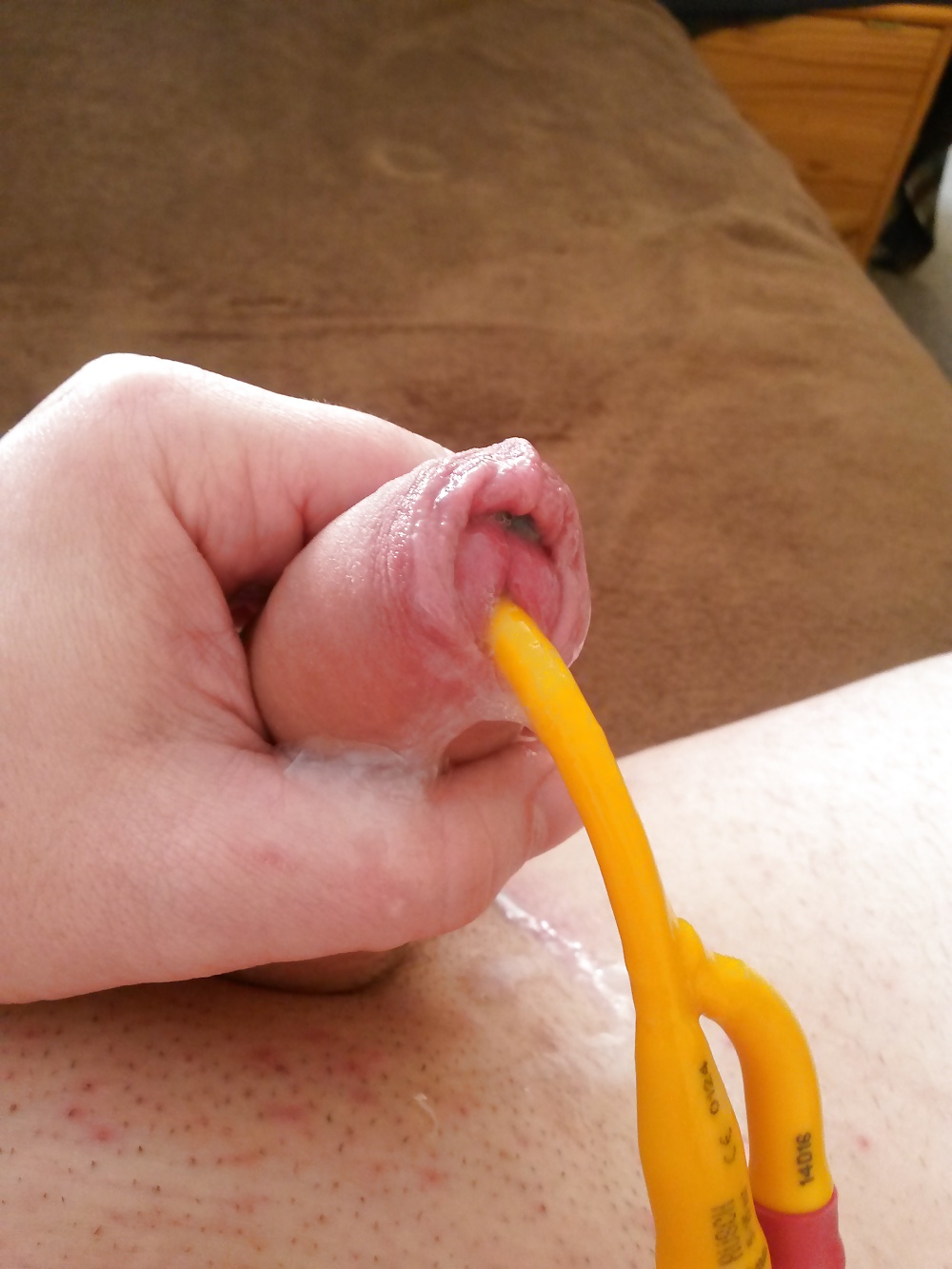 Katheter spiele
 #41017616