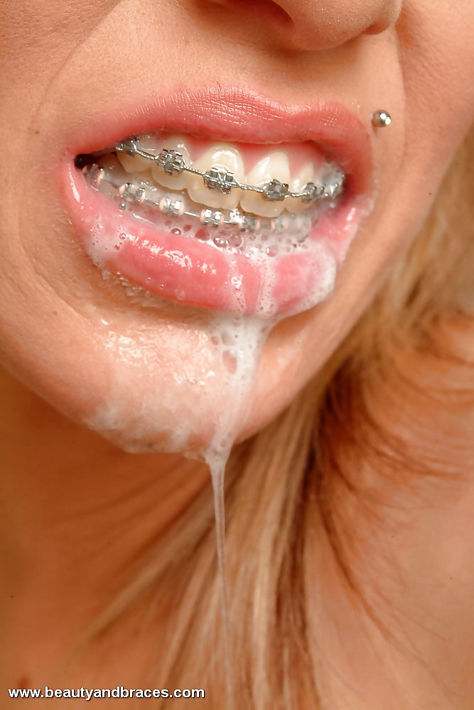 Cum Braces.. #28948664