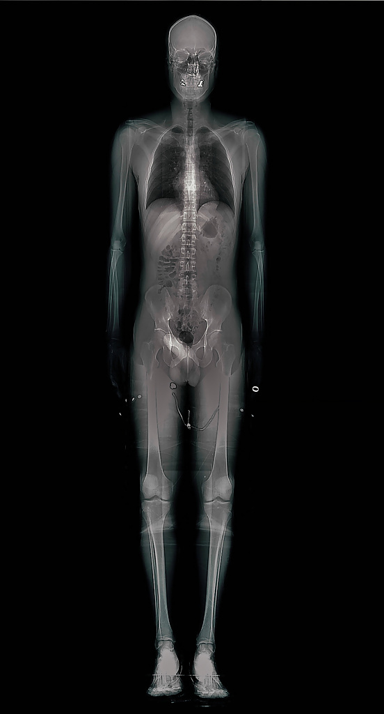 Sexo bajo resonancia magnética o radiografía
 #27849582