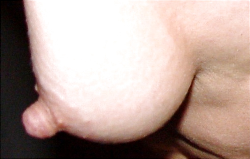 Lange Nippel #40521016