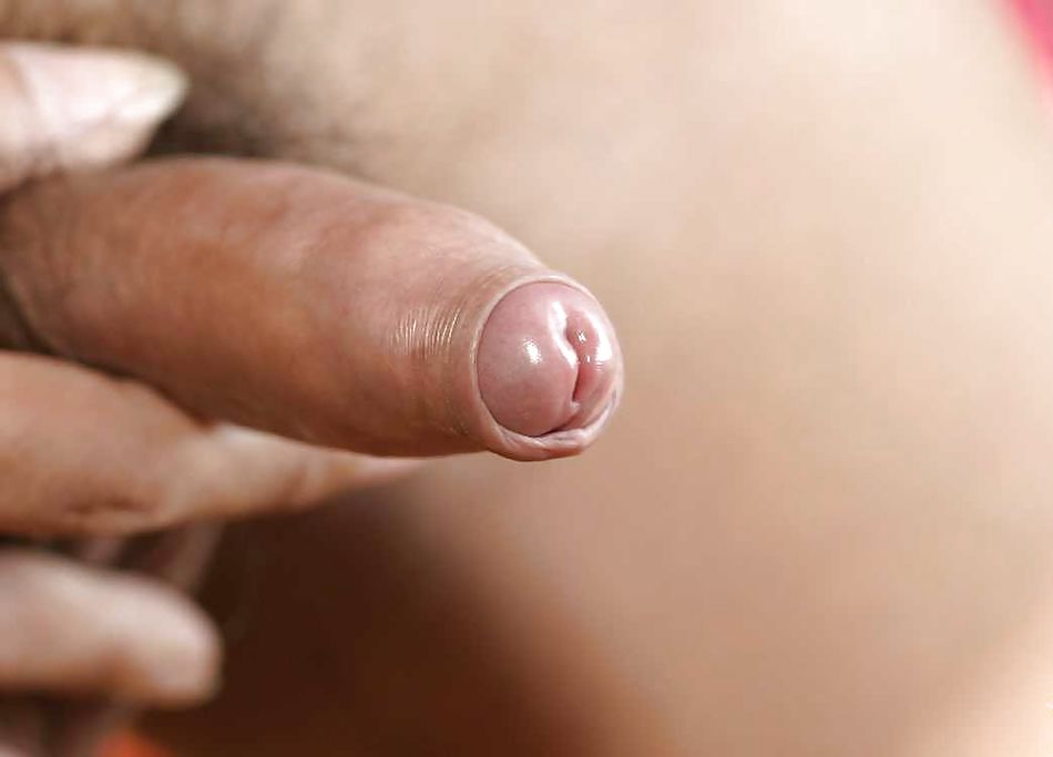 Skinn tiró hacia abajo
 #35994495