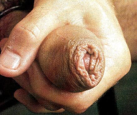 Neues vom wixxer
 #35943655