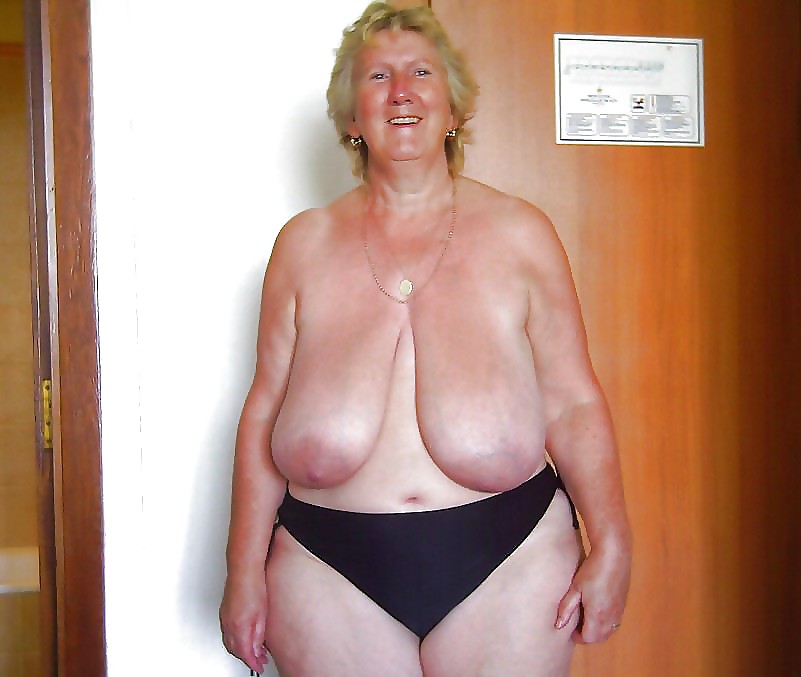 Stretch Marks, Scars and Saggy 27 #38015840