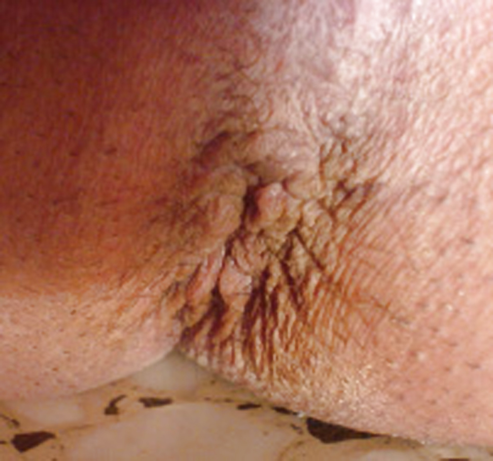 My body & asscunt, before & after depilation #40483326