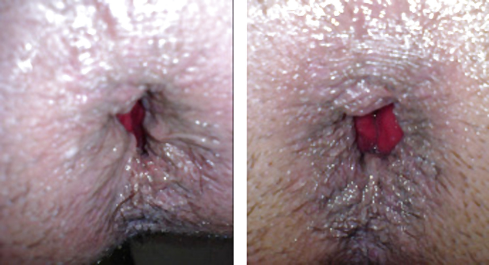 My body & asscunt, before & after depilation #40483328