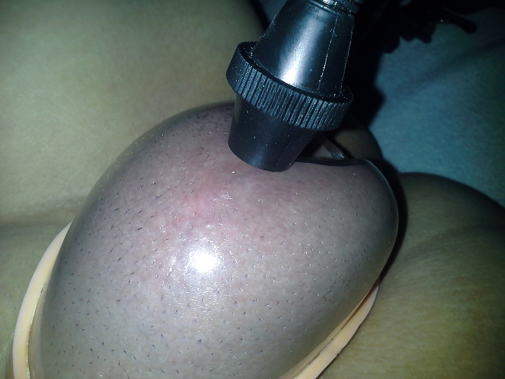 Adicción a las bombas
 #34875841