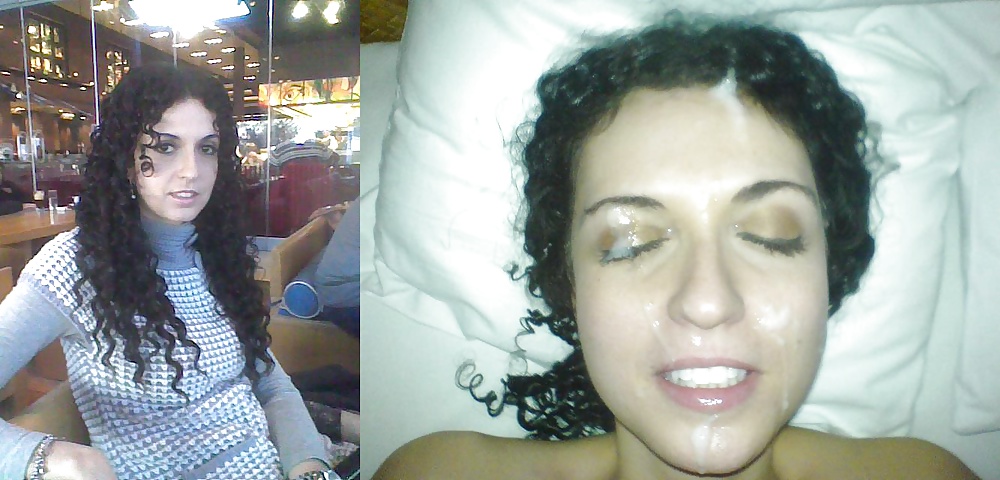 Prima e dopo i trattamenti del viso
 #25323952