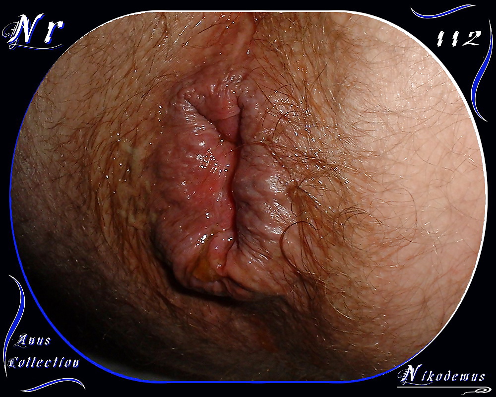 Anus Collection #31790552