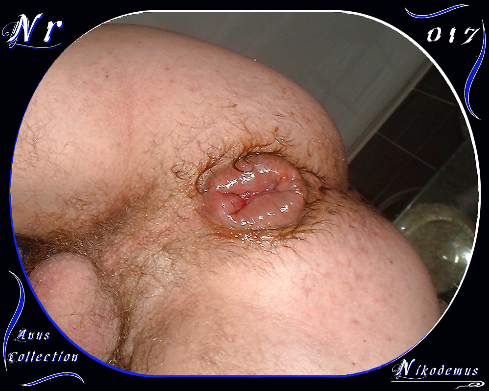 Anus Collection #31790616