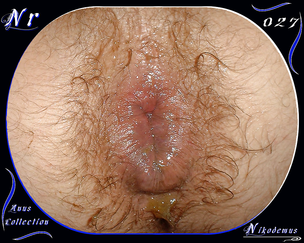 Anus Collection #31790626