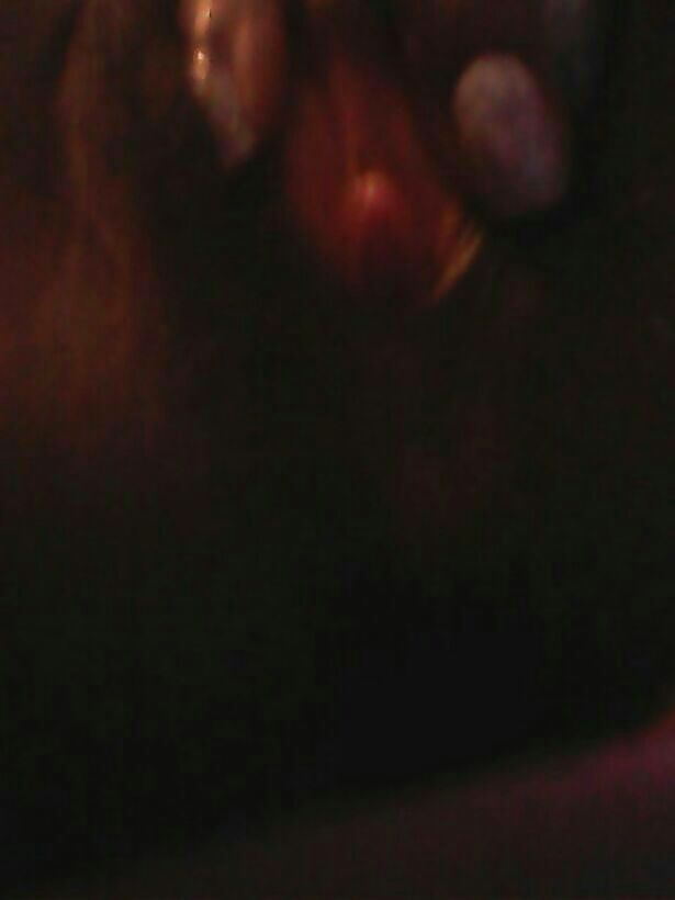 その他
 #23800300