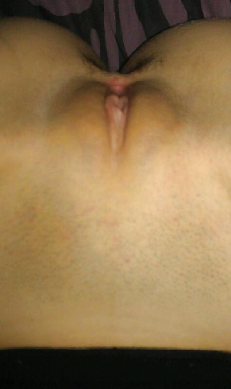 その他
 #23800305