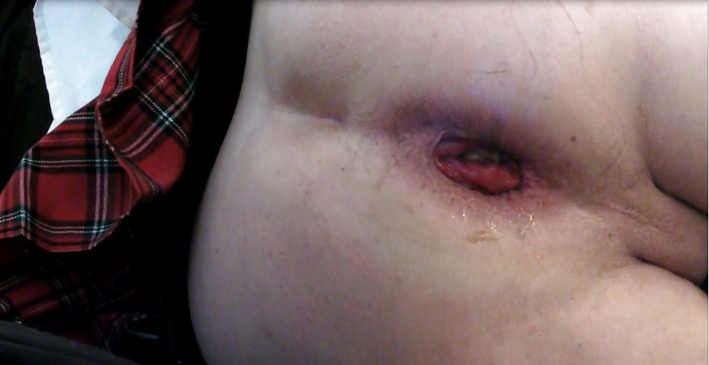 Kop4560000 anal gaping
 #33705014