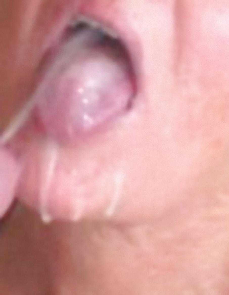 Dottoressa - milf doctor - bragas boca llena de cum
 #31422787