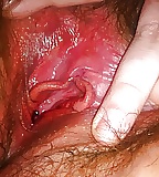 Yum
 #31680818