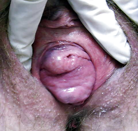 Prolapse in elderly ladies is lickable and suckable part 2 #26994772