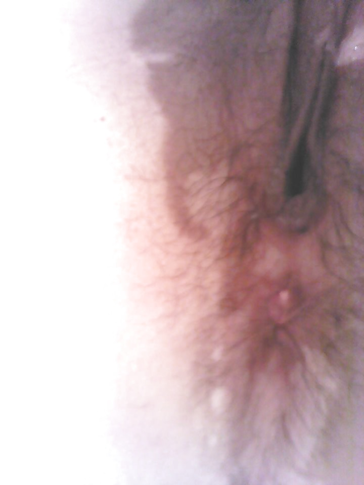 Ama giren merdane 
 #26703743