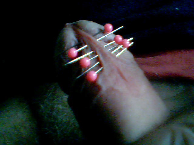 Pins in frenum #24444345