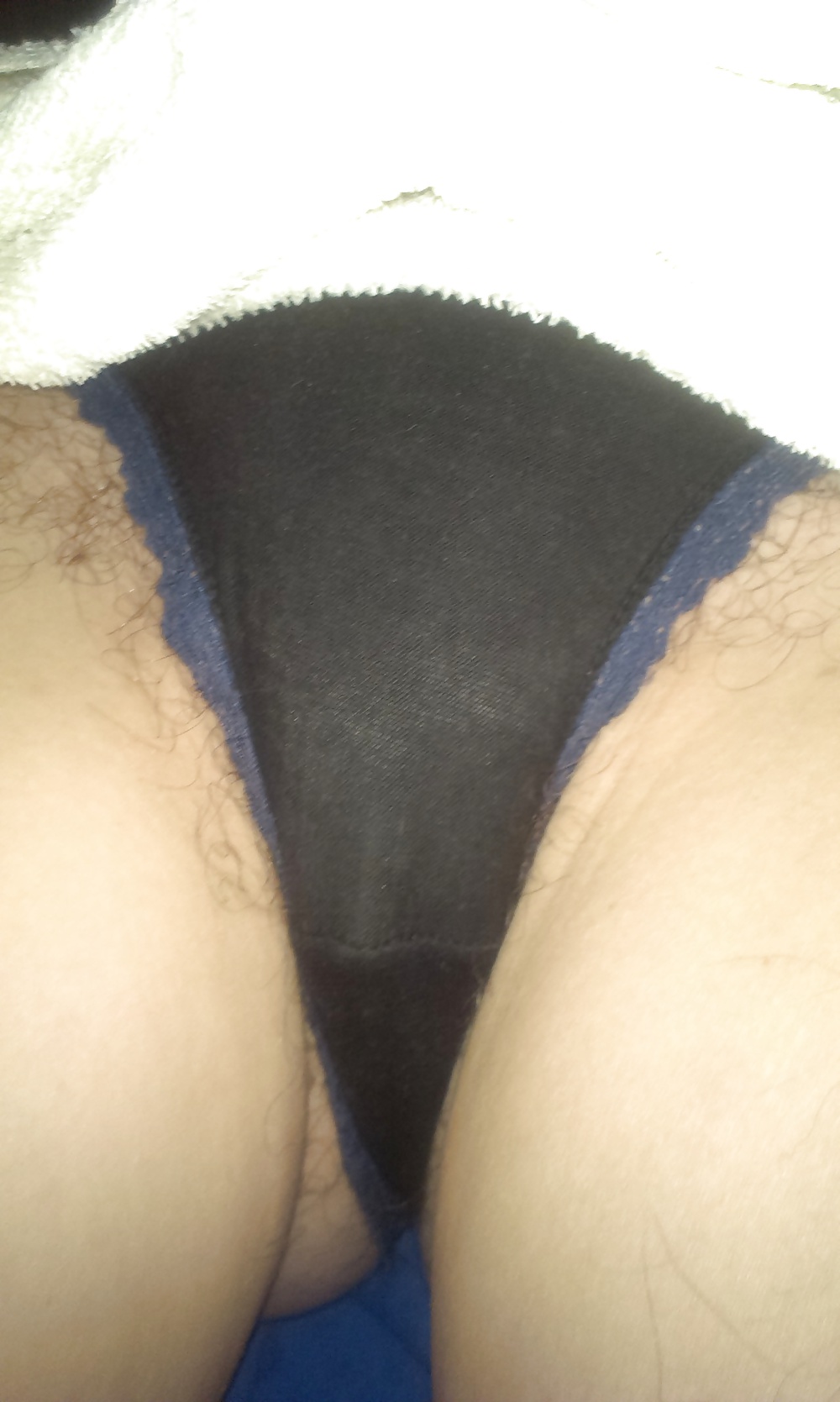 Peek peludo
 #27548312