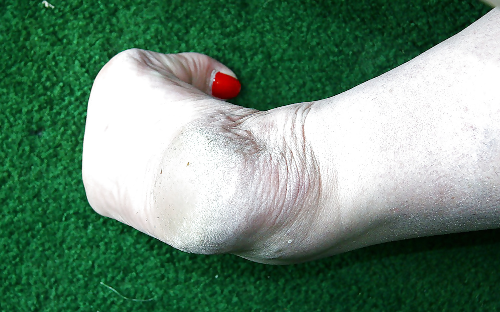 足：汚い足の裏 #49
 #39701501