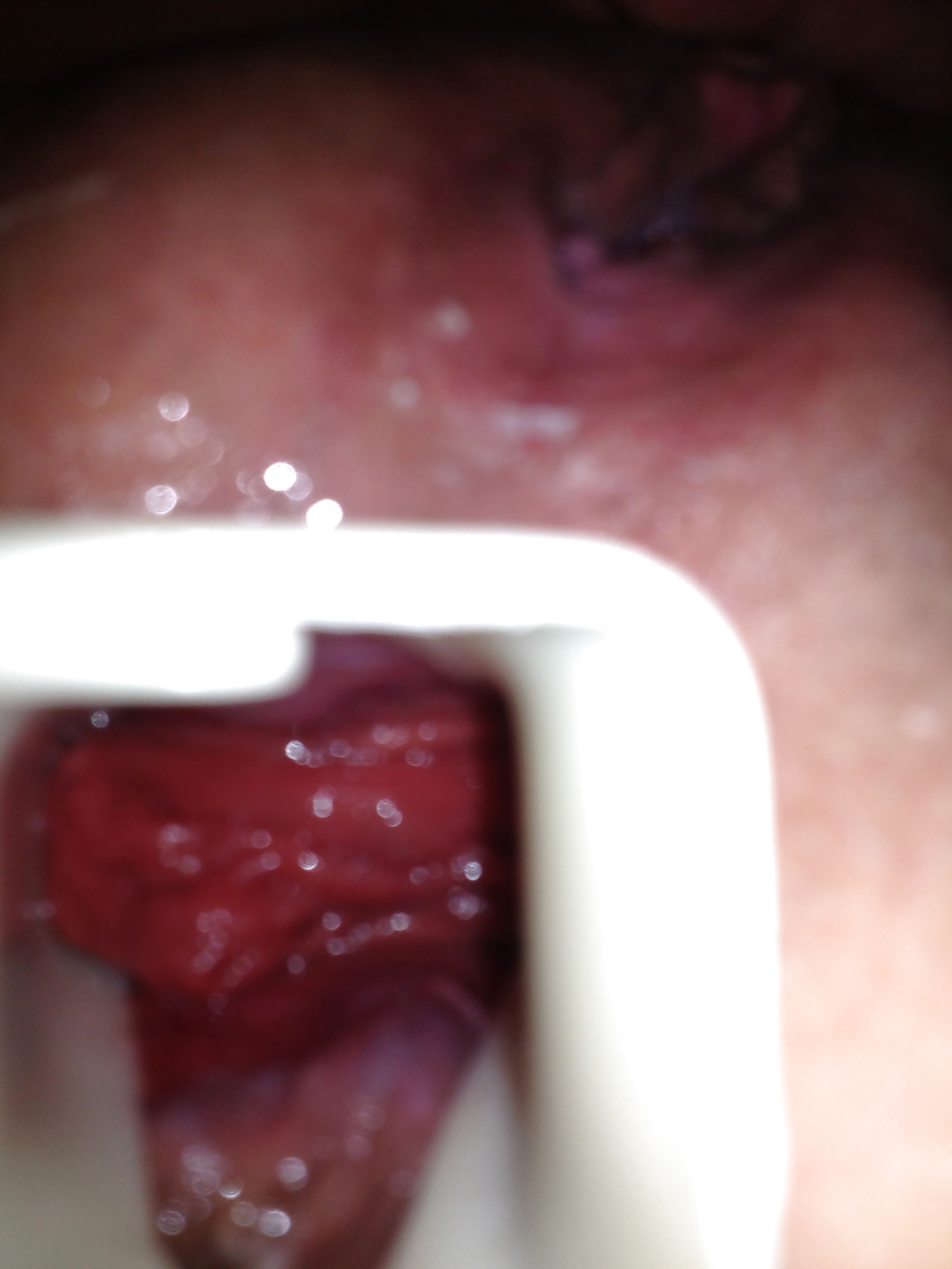 Sin moderación
 #24037609