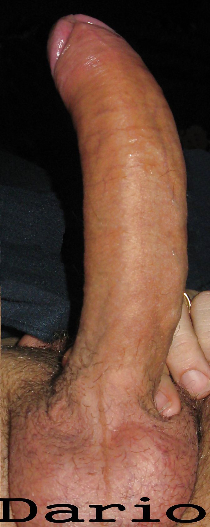 Cazzo dario
 #31161587