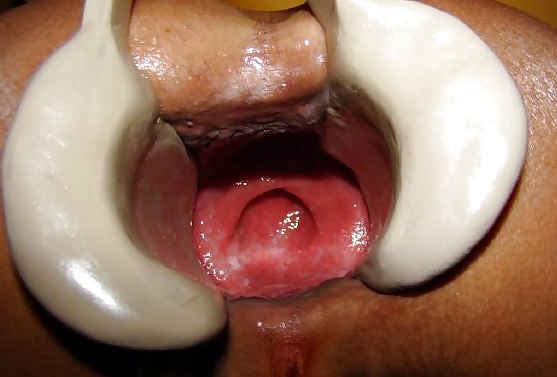 Asshole opened up wide #36334148